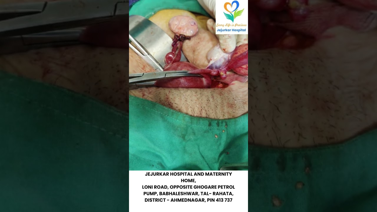 Clinical Case study by Gynecologist Dr. Swati Jejurkar, Ahmednagar