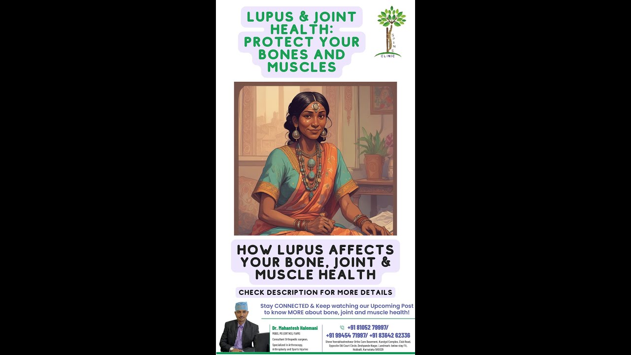 Lupus & Joint Health: Protect Your Bones and Muscles How Lupus Affects Your Bone, Joint & Muscle