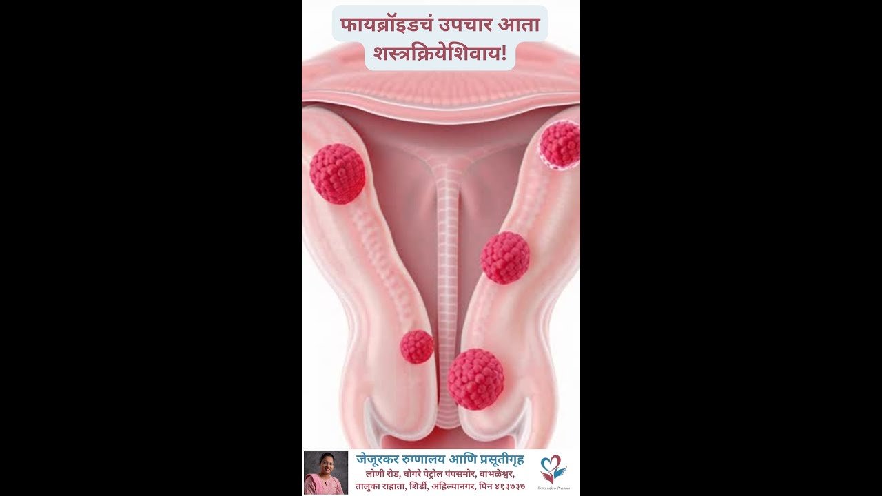 बाभळेश्वर, राहाता, शिर्डी परिसरातील फायब्रॉइड उपचारासाठी स्त्रीरोगतज्ज्ञ