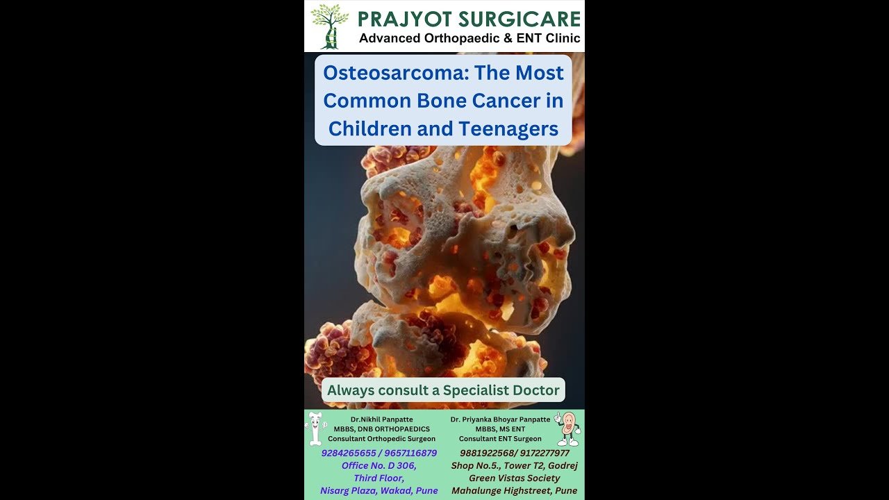 Osteosarcoma: The Most Common Bone Cancer in Children and Teenagers