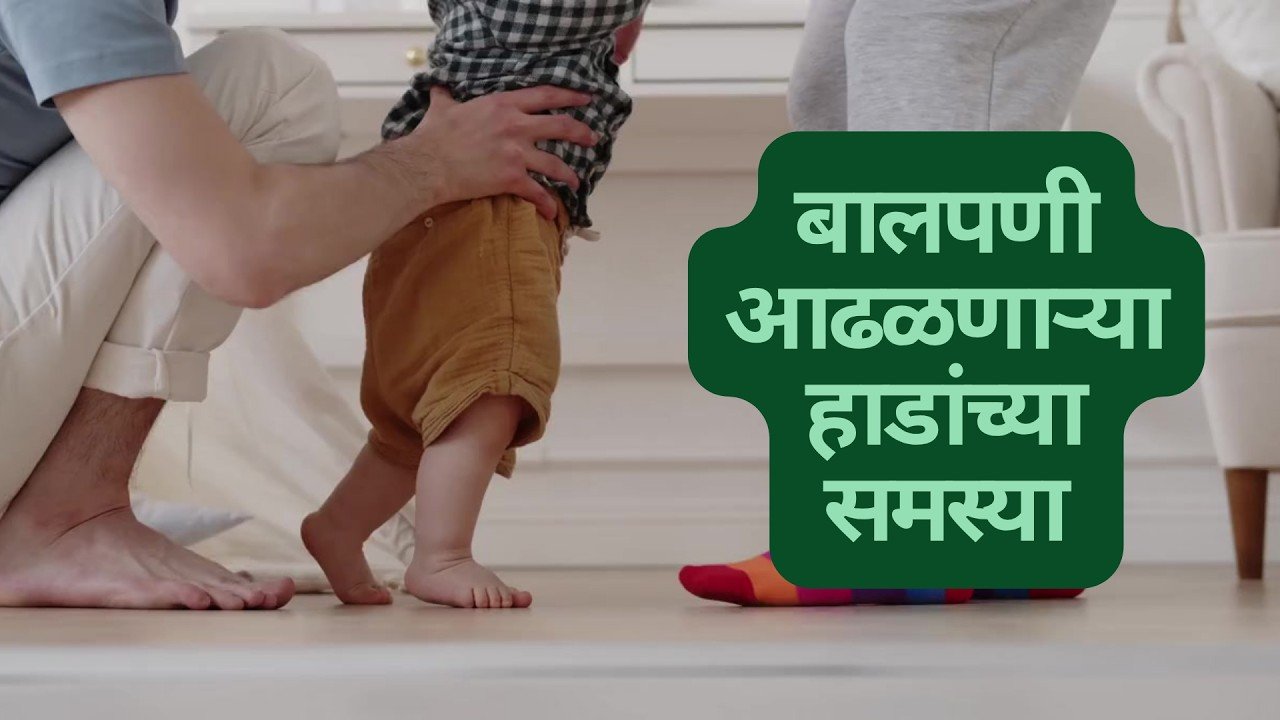 बालपणी आढळणाऱ्या हाडांच्या समस्या | बालकांमधील हाडांचे आजार |बालकांच्या हाडांच्या आरोग्याच्या समस्या
