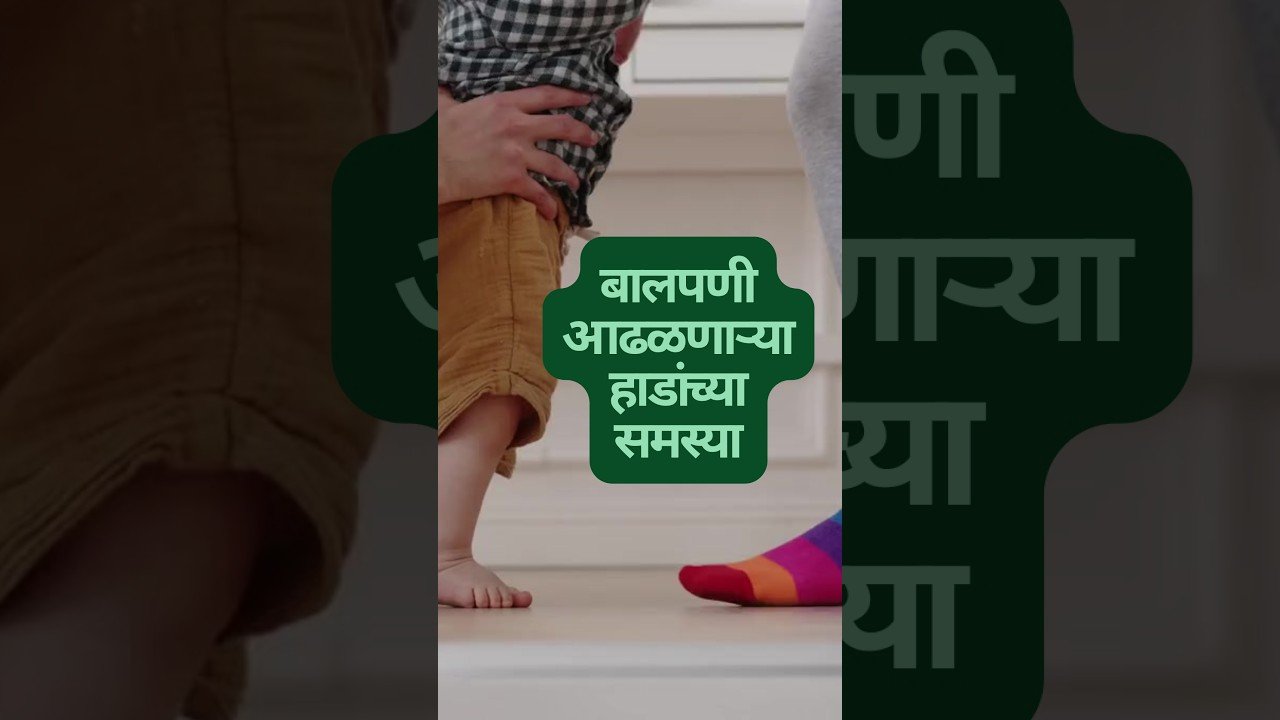 बालपणी आढळणाऱ्या हाडांच्या समस्या | बालकांमधील हाडांचे आजार बालकांच्या हाडांच्या आरोग्याच्या समस्या