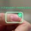 Nail capillary refill test capillary nail refill test Capillary Refill Time Test Peripheral Tissue Nail capillary refill test capillary nail refill test Capillary Refill Time Test Peripheral Tissue